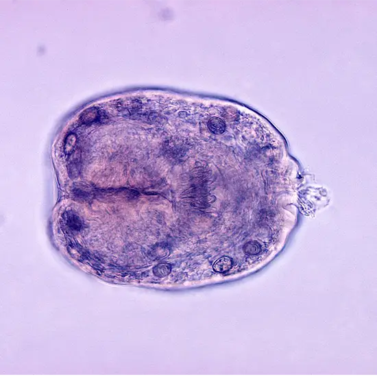 echinococcus detection for scolices in hydatid cyst fluid test